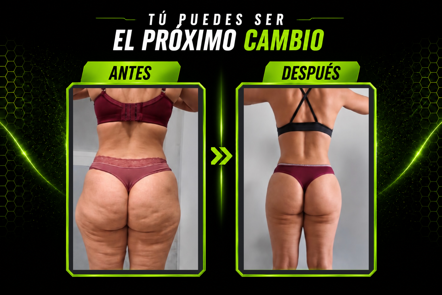 Transformación real — Ella, 40s · Glúteo y piernas