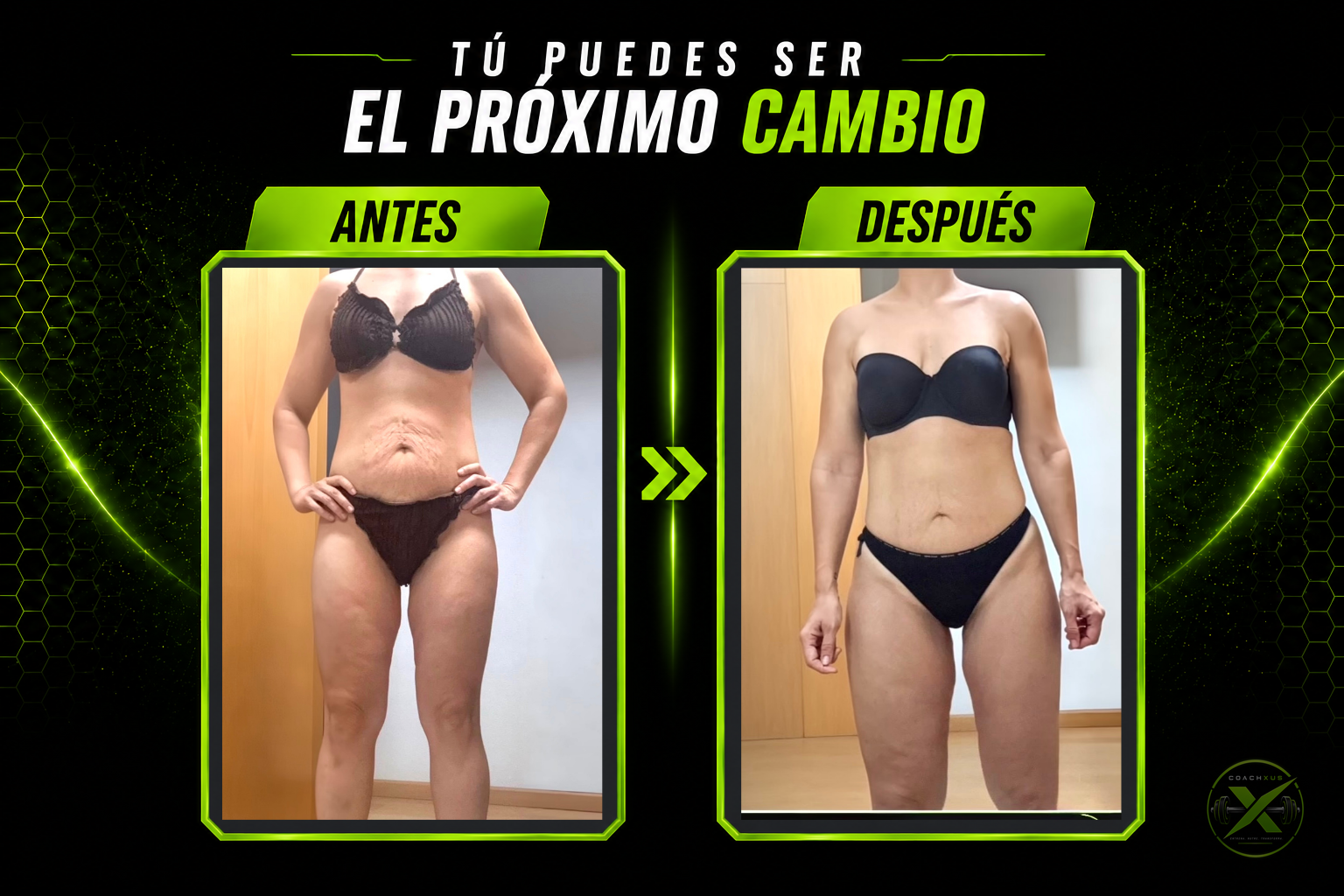 Transformación real — Ella, 40 años · Miedo a la piel flácida